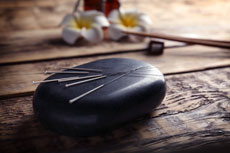 blog-020119-acupuncture.jpg Thumbnail